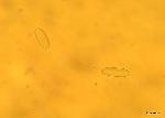 Urnula craterium ascospores