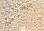 Inocybe flocculosa spores