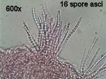 Trichoderma alutaceum asci with ascospores
