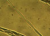Tolypocladium longisegmentum ascospore
