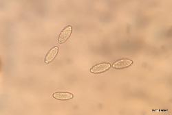 Peziza phyllogena ascospores